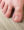Ingrown Toenail Treatment Dr Shazia