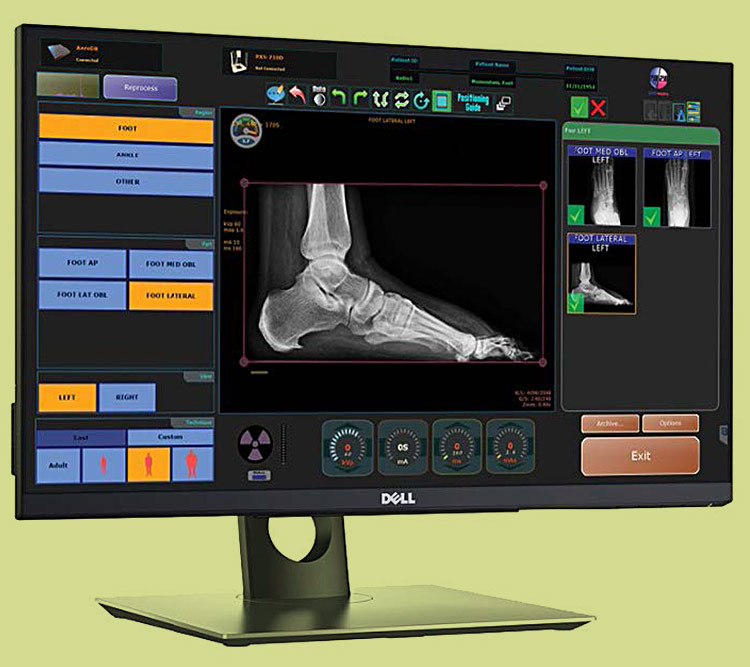 Digital imaging for Foot